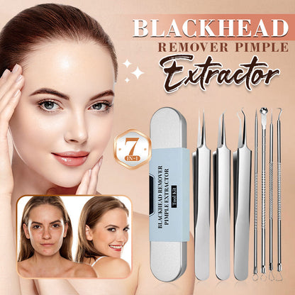 🩺 Medical Grade Blackhead & Blemish Extractor Kit – 50% OFF NOW! 🔥