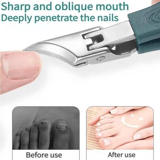 🔥Podiatrist-Recommended Nail Clippers - Ergonomic Angled Design for Toenails & Ingrowns - Limited 49% Deal